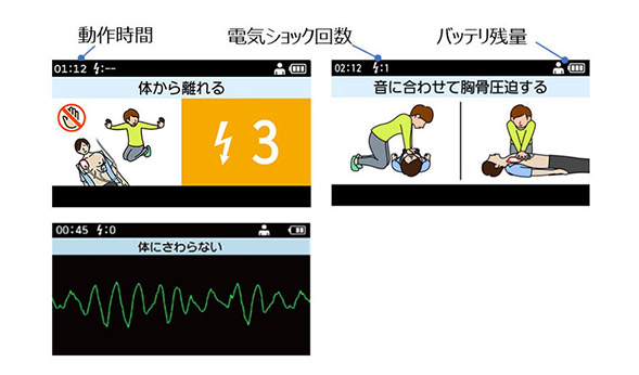 アニメーションガイド/心電図波形表示（iボタンで切替）